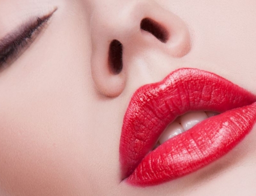 Ácido Hialurónico, para lucir esos labios que siempre quisiste