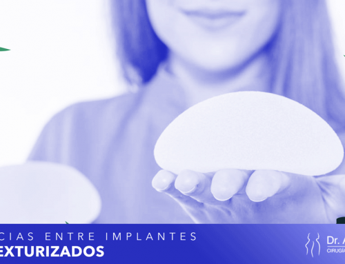 Diferencias entre Implantes Lisos y Texturizados