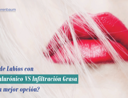 Aumento de Labios con Ácido Hialurónico VS Infiltración Grasa ¿Cuál es la mejor opción?